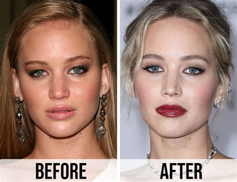 jennifer lawrence face|did jennifer lawrence have surgery.